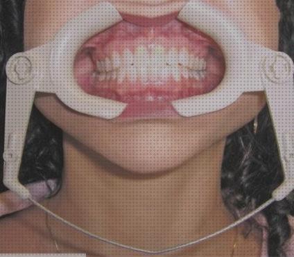 Las mejores abrebocas molt infantil edema oseo subcondral de rodilla ortopedia bami abrebocas dental