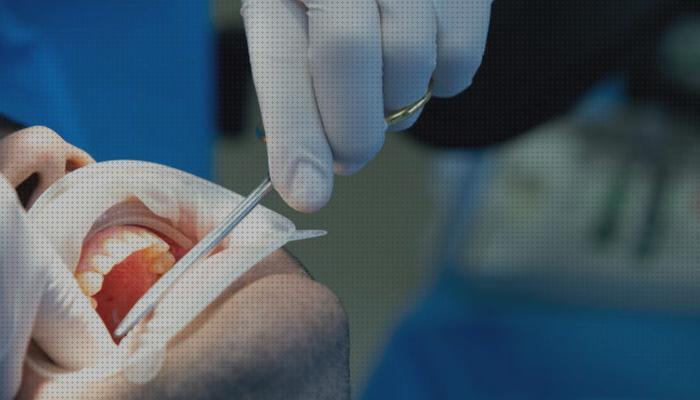 TOP 16 abrebocas dentales