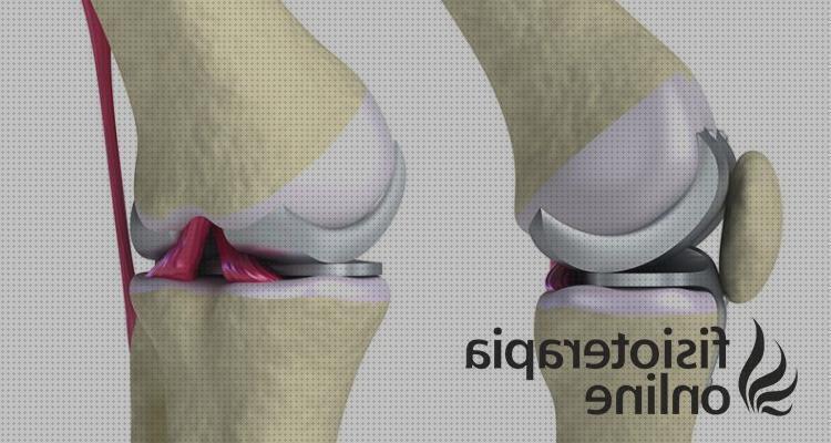 ¿Dónde poder comprar protesis andador para protesis de rodilla?