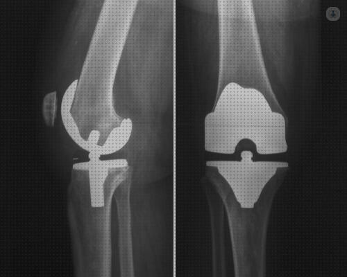 Las mejores protesis andador para protesis de rodilla