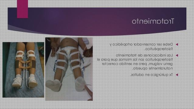 Las mejores marcas de genu aparato ortopédico para el genu varo