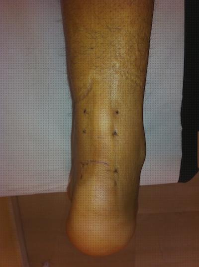 ¿Dónde poder comprar tendon bota ortopedica rotura tendon aquiles?