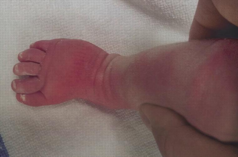 Las mejores niños botas ortopedicas para niños panama