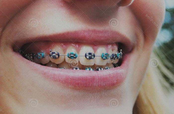 ¿Dónde poder comprar ortopedicos brackets ortopedicos?
