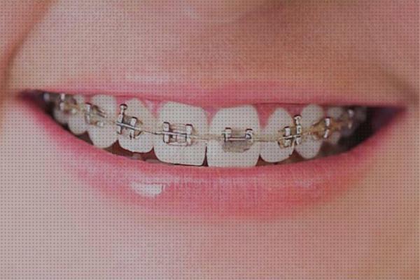 Los 18 Mejores brackets ortopedicos a la venta