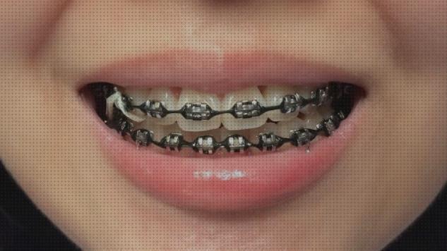 Las mejores ortopedicos brackets ortopedicos