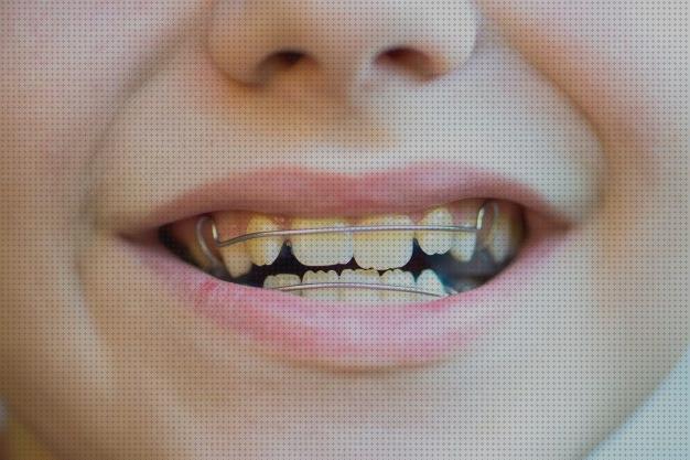Las mejores ortopedicos cepillos dentales ortopedicos