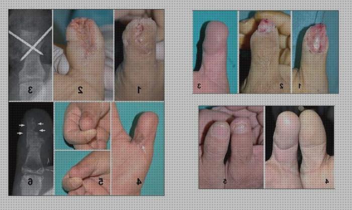 Review de cirurgia ortopédica