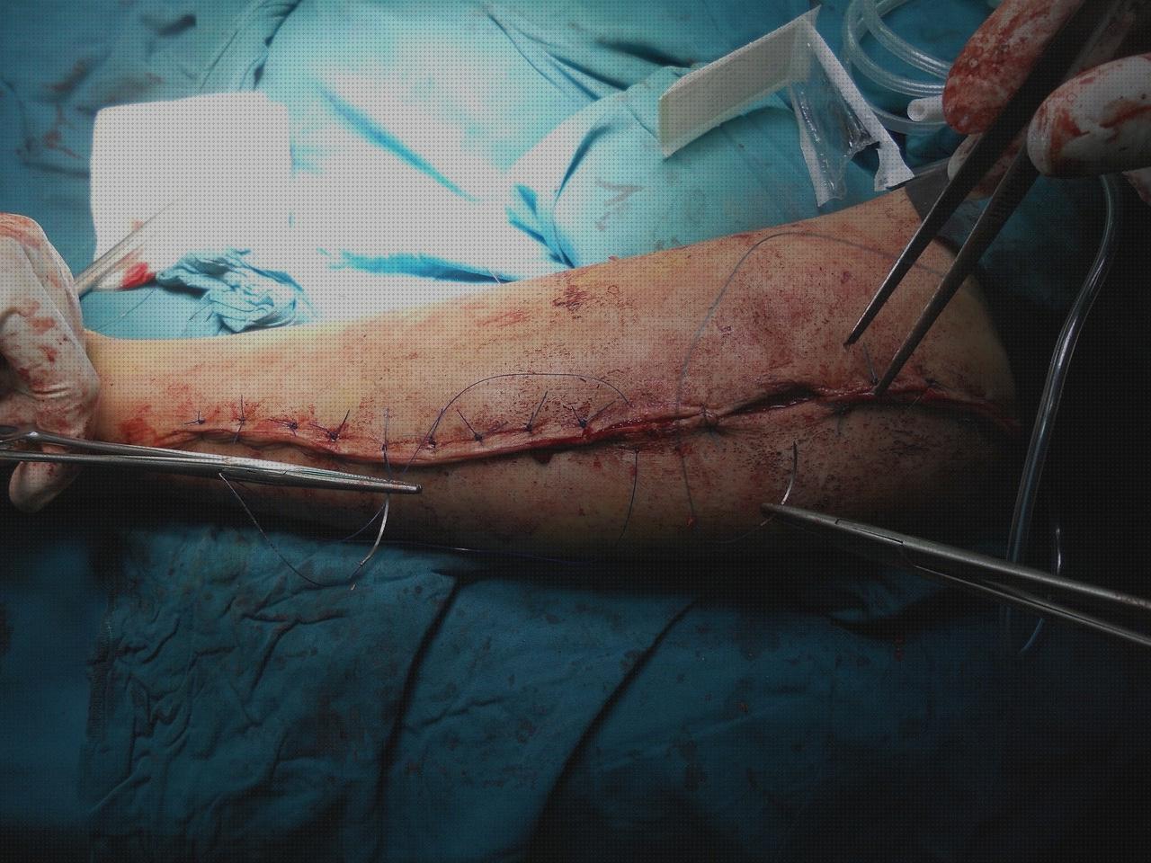 Análisis de los 6 mejores Clínicas Ortopédica Aguadulce