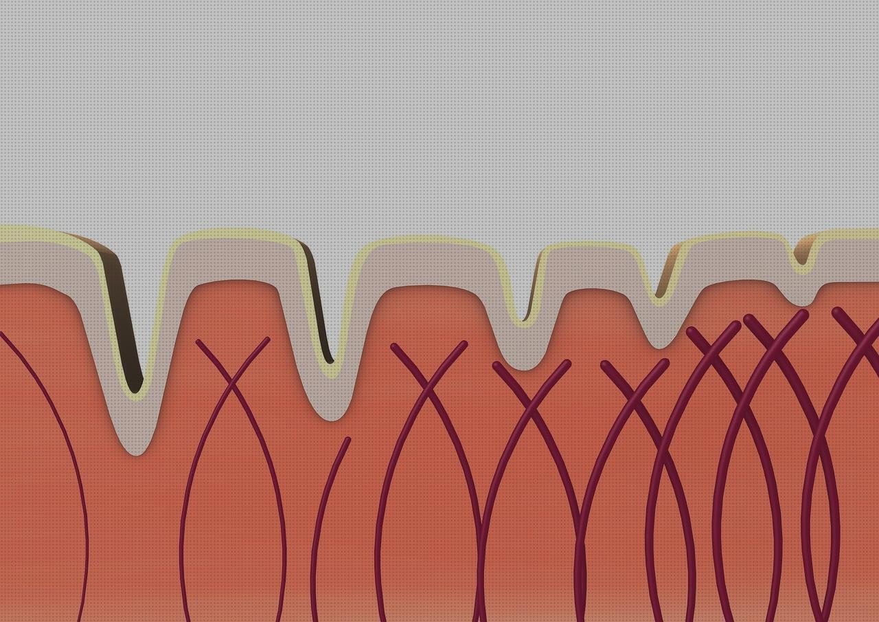 Las mejores adductor hernia edema oseo subcondral de rodilla ortopedia bami colageno alcavit