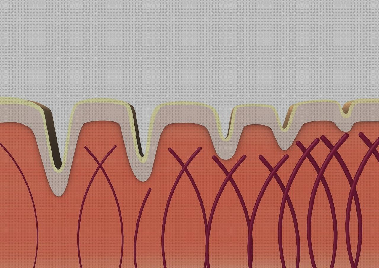 Las mejores adductor hernia edema oseo subcondral de rodilla ortopedia bami colageno viales