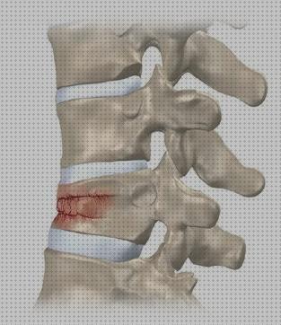 Las mejores marcas de corse corse ortopedico fractura vertebral