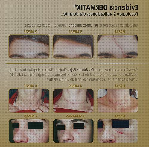 ¿Dónde poder comprar edema oseo subcondral de rodilla ortopedia bami columna cervical rectificada dermatix láminas de silicona?