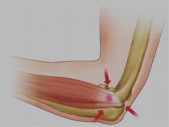 Las mejores rodillera ortopédica compex bionic electroestimulador compex epicondilitis