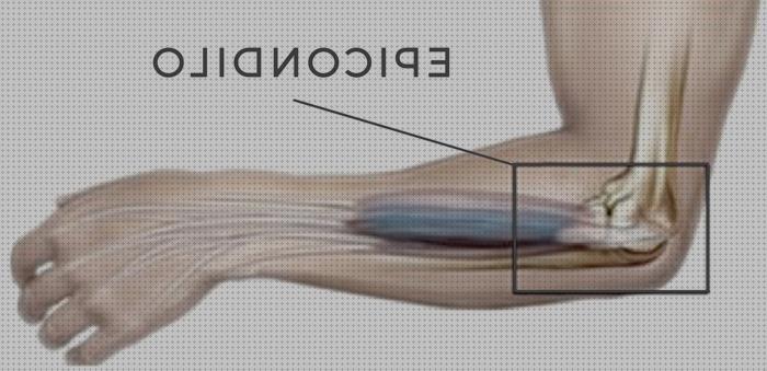 Review de epitroclea codo