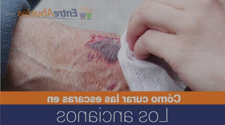 Análisis de los 28 mejores escaras en ancianos del mundo