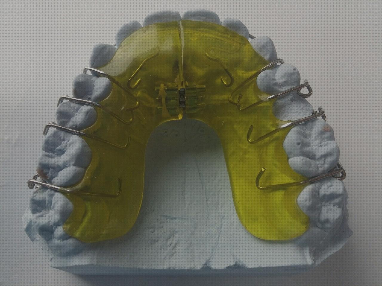 Review de ferula de arco