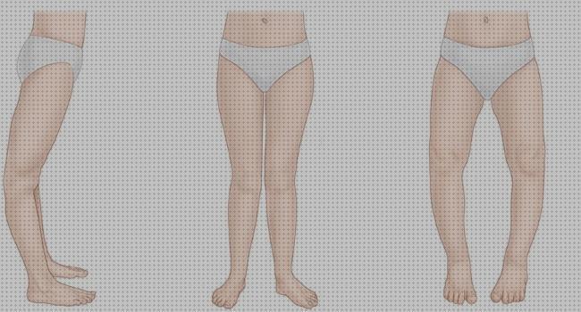 Review de genu recurvatum tratamiento ortopédico