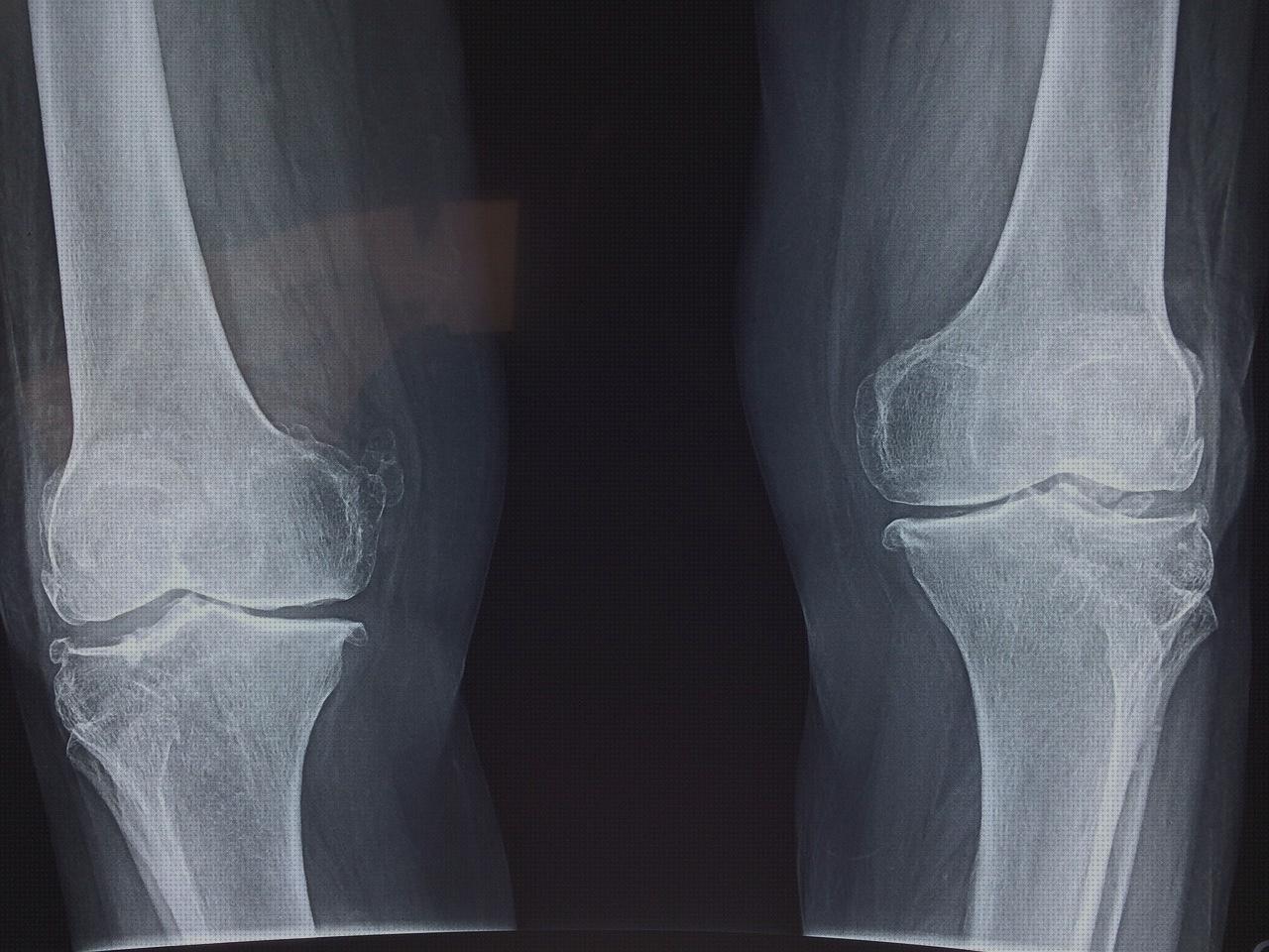 Análisis de los 20 mejores Digiflex Residencia Fortuny Albors Vaso De Disfagia Hipafix