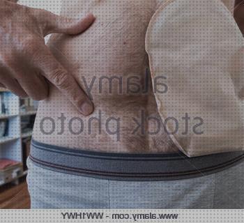 Las mejores marcas de amputacion supramaleolar adductor hernia edema oseo subcondral de rodilla ileostomia lado izquierdo