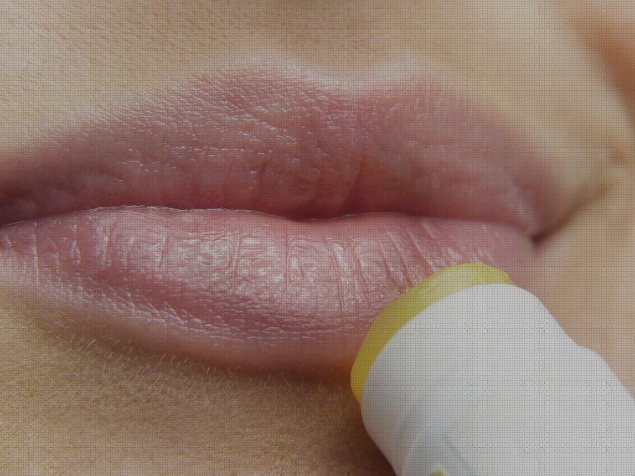 Review de irritacion ocular