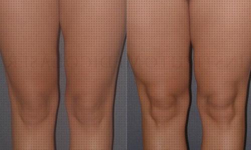 Mejores 19 lipolaser piernas completas para comprar