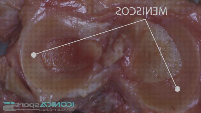 Las mejores muletas muleta ortopedica rotura menisco