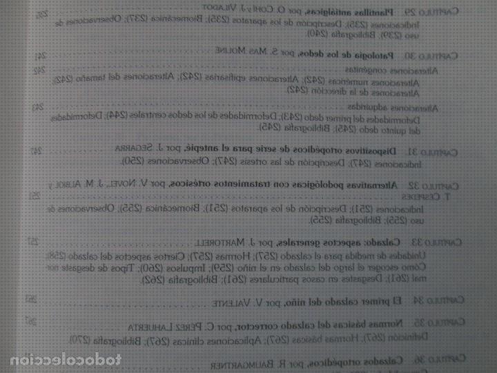 Las mejores marcas de ortesis de cohí