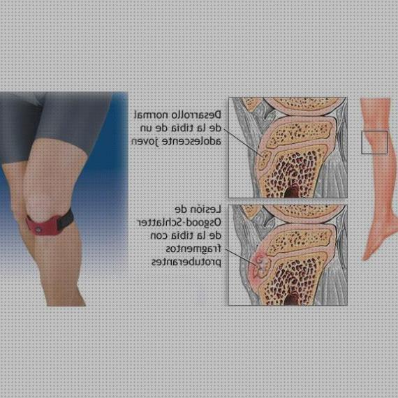 ¿Dónde poder comprar orliman ortesis ortesis osgood schlatter orliman?