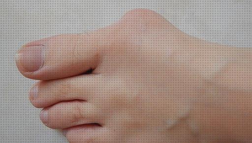 Las 16 Mejores Ortesis Para Juanetes Prim