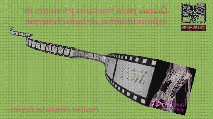 Mejores 23 ortesis paulina