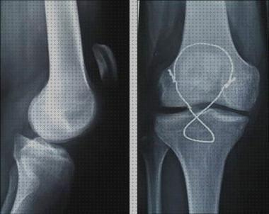 Análisis de las 26 mejores Ortesis Roturas Tendon Rotulina