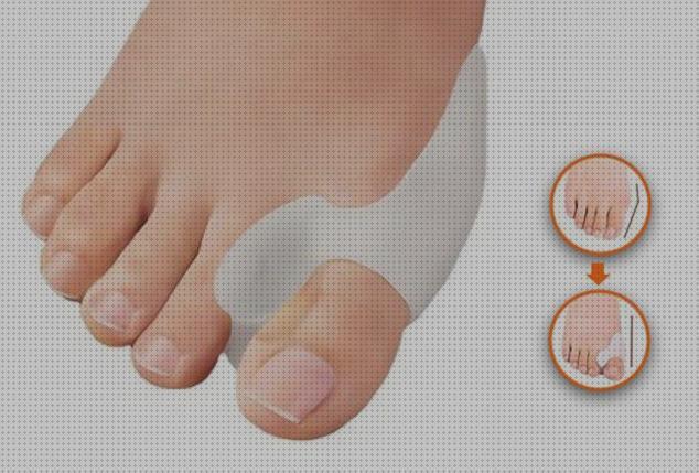 ¿Dónde poder comprar pies ortesis ortesis siliconas para pies?