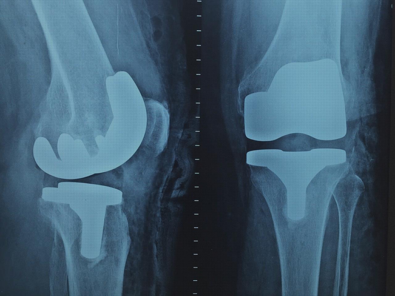 Las mejores columna cervical rectificada kons bambas ortopédicas almohada de viaje cervical concord ortopedia acosta