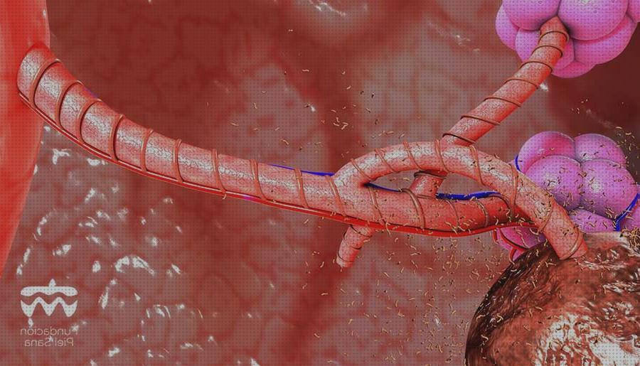 ¿Dónde poder comprar parches colchón antiescaras silla antiescaras parches antiescaras en hidrosadenitis?