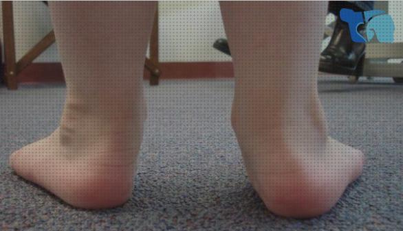 Las mejores marcas de plantilla ortopedica para pie hacia dentro