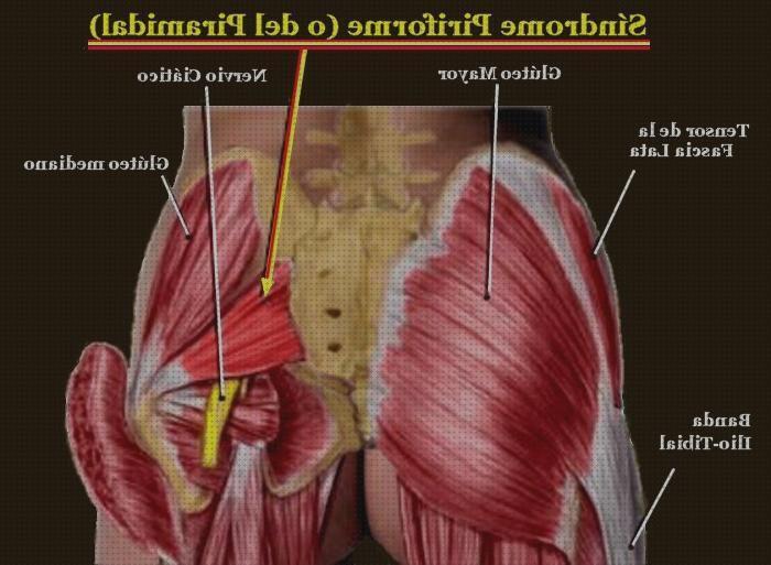 ¿Dónde poder comprar plantillas plantillas ortopedicas a ratos y dolor isquiotibiales?