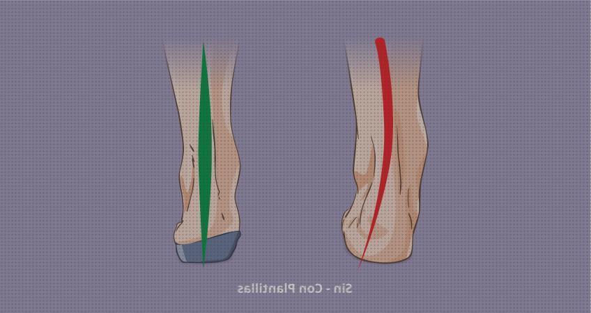 Review de plantillas ortopedicas crevillente