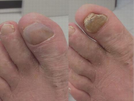 ¿Dónde poder comprar podortosis ortesis?