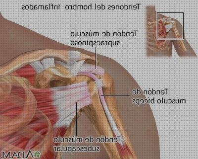 Opiniones de las 20 mejores Tendinitis Guitarras Manos Izquierdas
