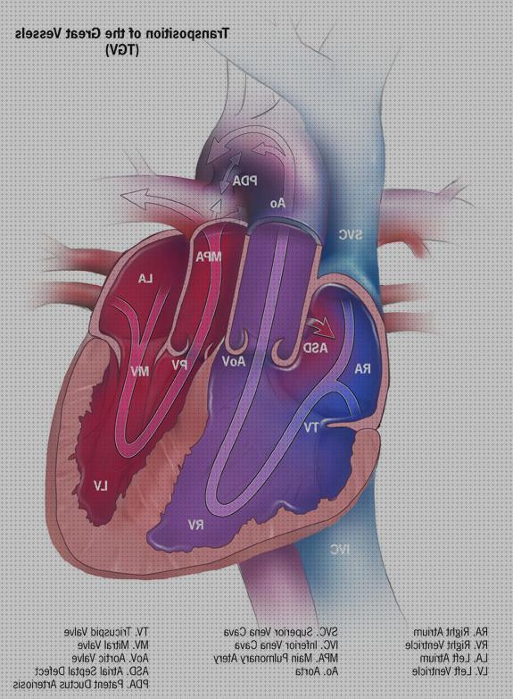 Las mejores motor tga edema oseo subcondral de rodilla ortopedia bami tga medical