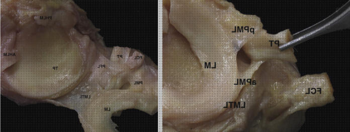 Las mejores marcas de tibios ortesis tibia