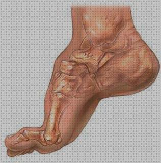 Análisis de los 33 mejores Zapatos Ortopedicos De Mujeres Pies Cavi